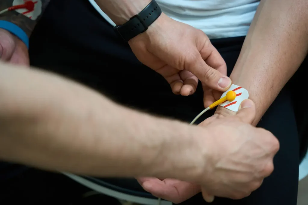 Paciente recibiendo estudios de conducción nerviosa en el antebrazo