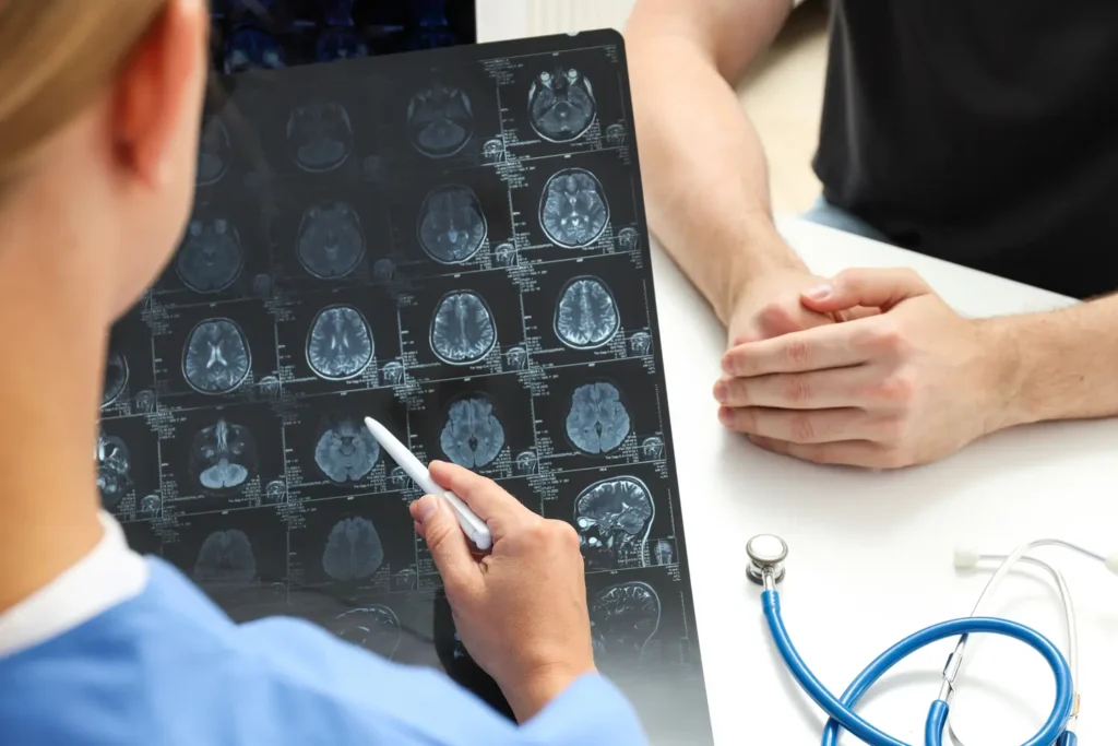 ¿Qué es un accidente cerebrovascular? Y por qué es importante detectarlo a tiempo 2 » Accidente cerebrovascular,Que es un accidente cerebrovascular,Tipos de accidentes cerebrovasculares,Síntomas de un accidente cerebrovascular,Rehabilitación robótica los tipos de accidentes cerebrovasculares isquémico y hemorrágico- clinica de neurologia robotica